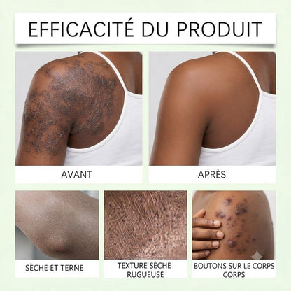 Crème Antidouleur au Magnésium